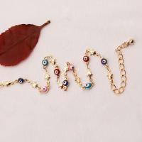uploads/erp/collection/images/Fashion Jewelry/zuowen/XU0514699/img_b/XU0514699_img_b_4